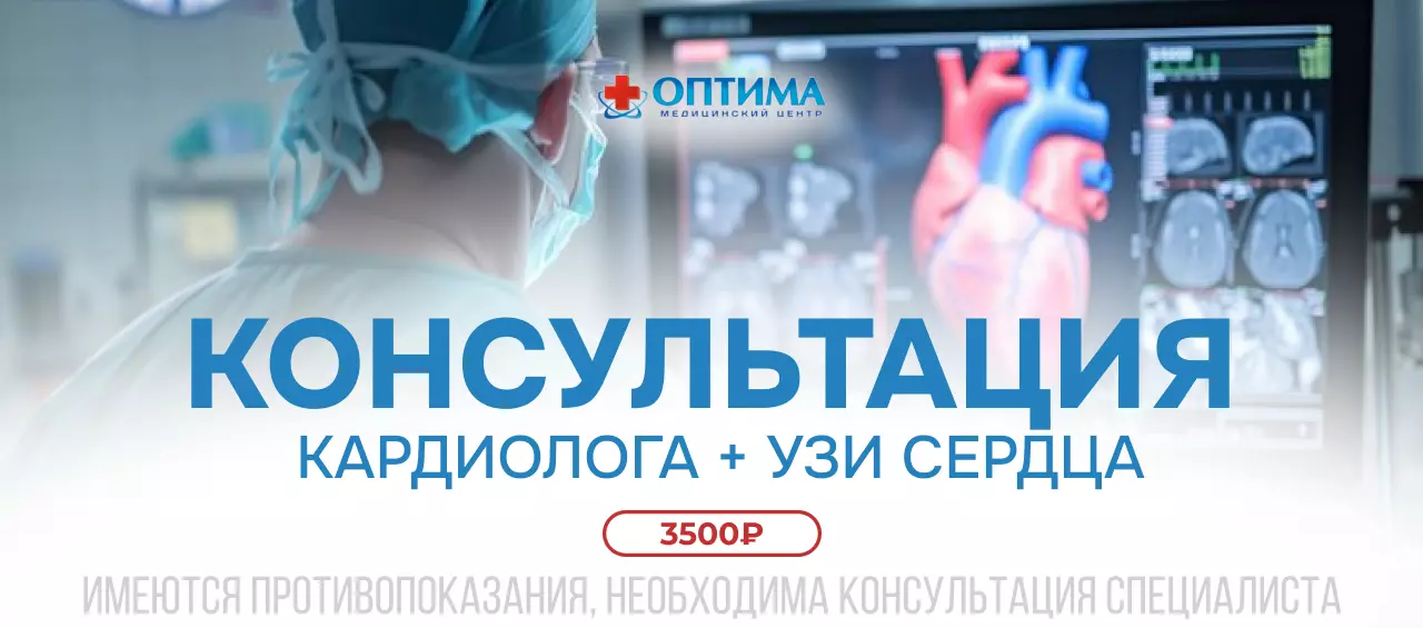 оптима 7